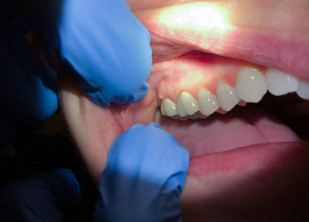 Best Emergency Orthodontic Repairs in Svis, IL